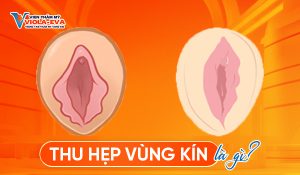 thu-hep-vung-kin-la-gi