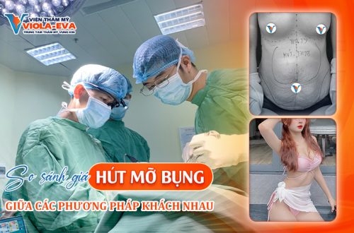 So sánh giá hút mỡ bụng giữa các phương pháp khác nhau?