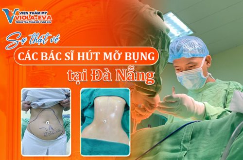 su-that-ve-cac-bac-si-hut-mo-bung-tai-da-nang