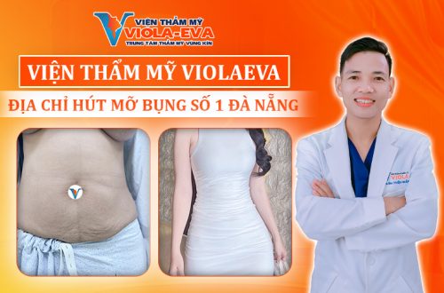 vien-tham-my-violaeva-dia-chi-hut-mo-bung-so-1-da-nang