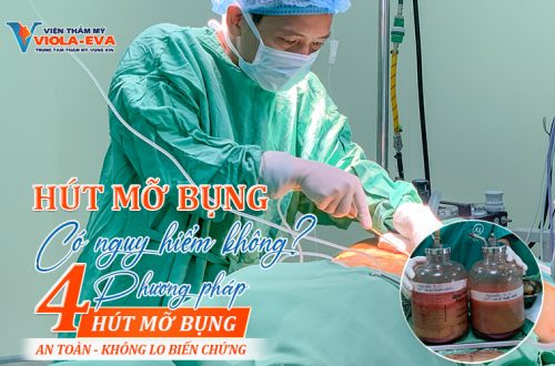 Hút mỡ bụng có nguy hiểm không? 04 phương pháp hút mỡ bụng an toàn, không lo biến chứng