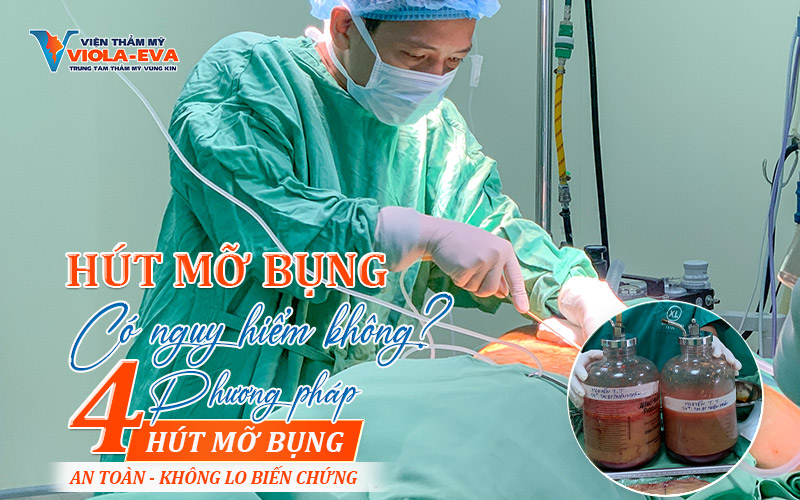 Hút mỡ bụng có nguy hiểm không? 04 phương pháp hút mỡ bụng an toàn, không lo biến chứng