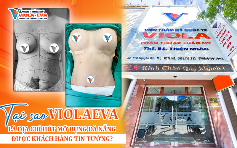 Tại sao ViolaEva là địa chỉ hút mỡ bụng Đà Nẵng được khách hàng tin tưởng?