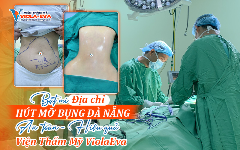 Bật mí địa chỉ hút mỡ bụng Đà Nẵng an toàn, hiệu quả - Viện Thẩm Mỹ ViolaEva