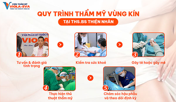 quy-trinh-tham-my-vung-kin-an-toan