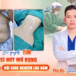 Bí quyết tìm bác sĩ hút mỡ bụng tại Đà Nẵng với kinh nghiệm lâu năm