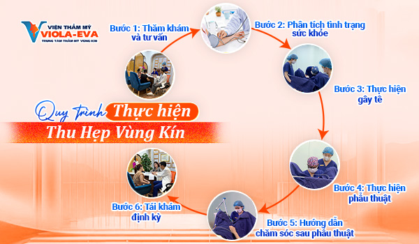 Quy trình thu hẹp vùng kín