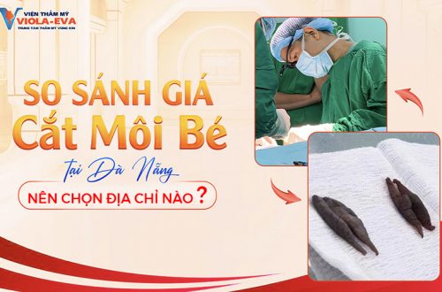 So sánh giá cắt môi bé tại Đà Nẵng: Nên chọn địa chỉ nào?