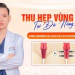 Thu hẹp vùng kín tại Đà Nẵng: Kinh nghiệm và chia sẻ từ chuyên gia