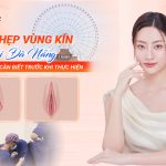 Thu hẹp vùng kín tại Đà Nẵng? Những điều cần biết trước khi thực hiện