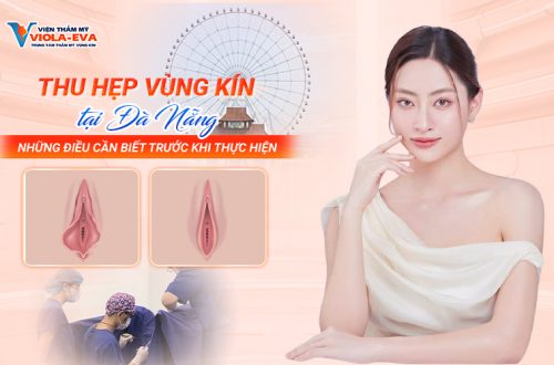 Thu hẹp vùng kín tại Đà Nẵng? Những điều cần biết trước khi thực hiện