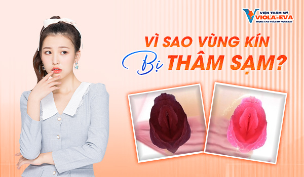 vi-sao-vung-kin-bi-tham-sam