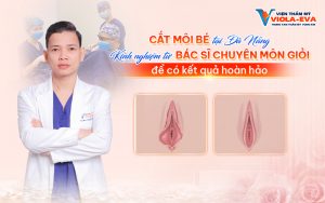 Cắt môi bé tại Đà Nẵng: Kinh nghiệm từ bác sĩ chuyên môn giỏi để có kết quả hoàn hảo