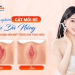 Kinh nghiệm cắt môi bé tại Đà Nẵng: Những điều bạn nên biết trước khi thực hiệnm-cat-moi-be-tai-da-nang-nhung-dieu-ban-nen-biet-truoc-khi-thuc-hien