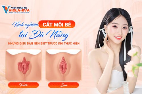 Kinh nghiệm cắt môi bé tại Đà Nẵng: Những điều bạn nên biết trước khi thực hiệnm-cat-moi-be-tai-da-nang-nhung-dieu-ban-nen-biet-truoc-khi-thuc-hien