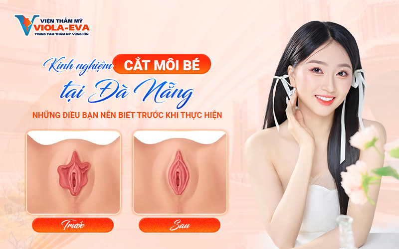 Kinh nghiệm cắt môi bé tại Đà Nẵng: Những điều bạn nên biết trước khi thực hiệnm-cat-moi-be-tai-da-nang-nhung-dieu-ban-nen-biet-truoc-khi-thuc-hien