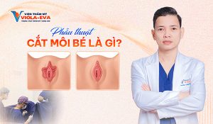 Phẫu thuật cắt môi bé là gì?