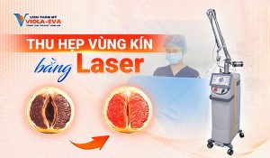Thu hẹp vùng kín bằng laser