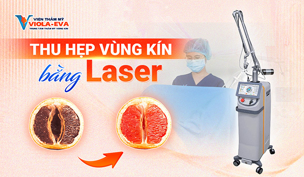 Thu hẹp vùng kín bằng laser