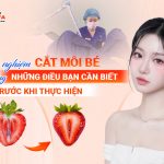 kinh-nghiem-cat-moi-be-o-da-nang-nhung-dieu-ban-can-biet-truoc-khi-thuc-hien