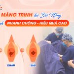 Vá màng trinh tại Đà Nẵng: Quy trình nhanh chóng, hiệu quả cao