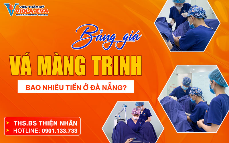 bang-gia-va-mang-trinh-bao-nhieu-tien-o-da-nang