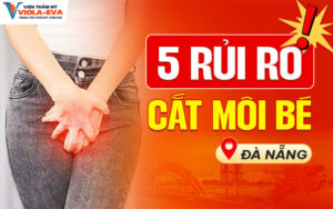 5-rui-ro-cat-moi-be-tai-da-nang