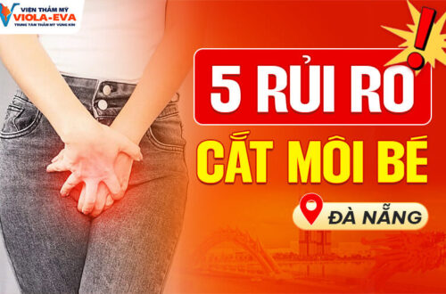 5-rui-ro-cat-moi-be-tai-da-nang