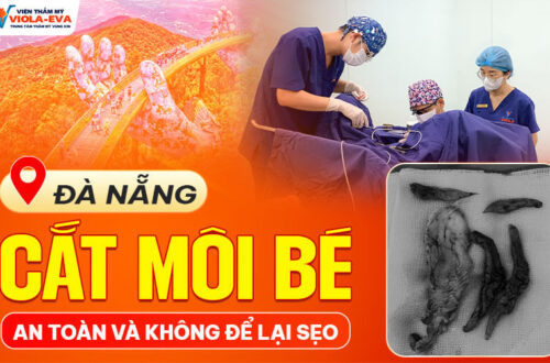 Bác sĩ tiết lộ bí quyết thực hiện cắt môi bé ở Đà Nẵng an toàn và không để lại sẹo