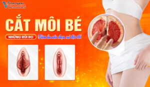 nhung-rui-ro-tiem-an-neu-chon-sai-dia-chi-cat-moi-be