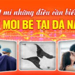 bi-mat-ve-nhung-dieu-can-biet-cat-moi-be-da-nang