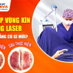 thu-hep-vung-kin-bang-laser-tai-da-nang-co-gi-moi