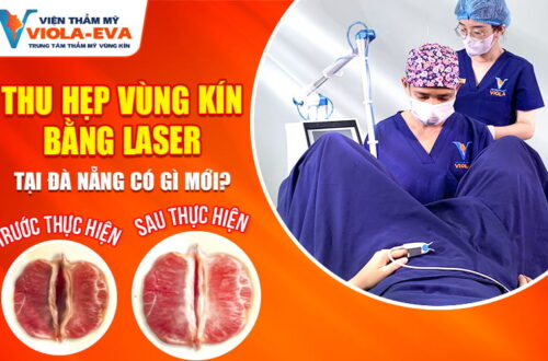 thu-hep-vung-kin-bang-laser-tai-da-nang-co-gi-moi