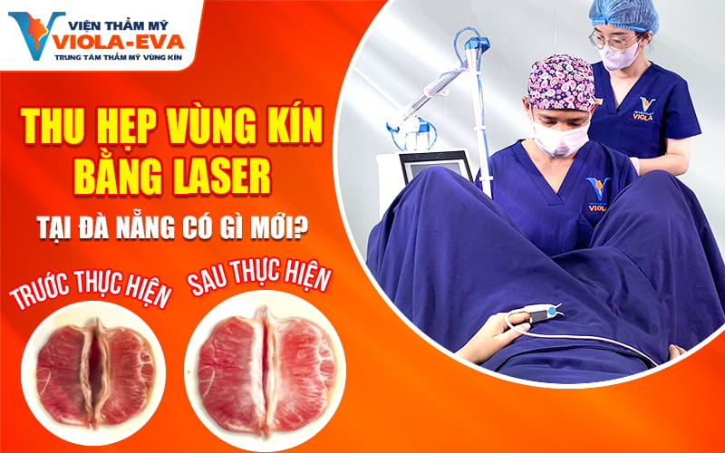 thu-hep-vung-kin-bang-laser-tai-da-nang-co-gi-moi