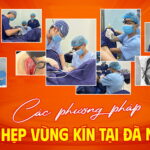 Cac-phuong-phap-thu-hep-vung-kin-tai-da-nang (1)