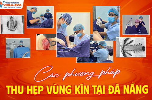Cac-phuong-phap-thu-hep-vung-kin-tai-da-nang (1)