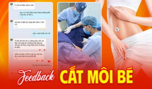 Feedback-cat-moi-be