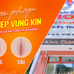 Giai-phap-thu-hep-vung-kin-dep-tu-nhien-tai-da-nang