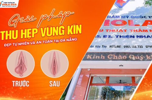 Giai-phap-thu-hep-vung-kin-dep-tu-nhien-tai-da-nang