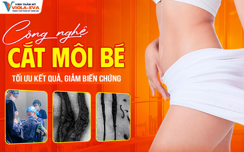 cong-nghe-cat-moi-be-tai-da-nang