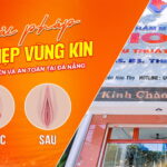 giai-phap-thu-hep-vung-kin-tai-da-nang