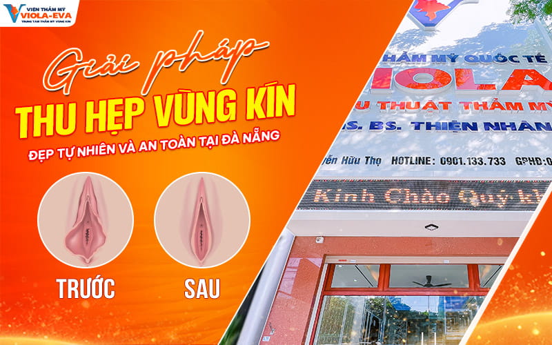 giai-phap-thu-hep-vung-kin-tai-da-nang