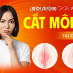 loi-ich-va-rui-ro-khi-cat-moi-be-tai-da-nang (1)