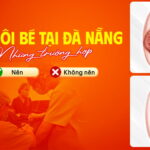 nhung-truong-hop-nen-va-khong-nen-cat-moi-be-tai-da-nang (1)