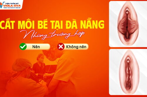 nhung-truong-hop-nen-va-khong-nen-cat-moi-be-tai-da-nang (1)