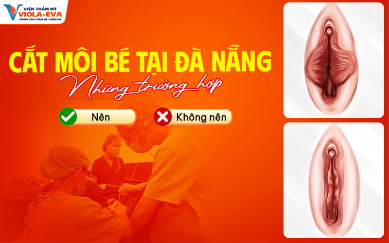 nhung-truong-hop-nen-va-khong-nen-cat-moi-be-tai-da-nang (1)