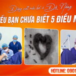 lao-hoa-khong-con-la-noi-lo-voi-cang-da-mat-tai-da-nang