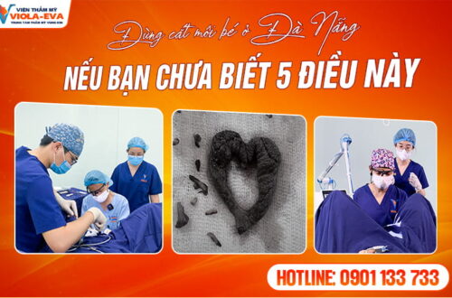 lao-hoa-khong-con-la-noi-lo-voi-cang-da-mat-tai-da-nang
