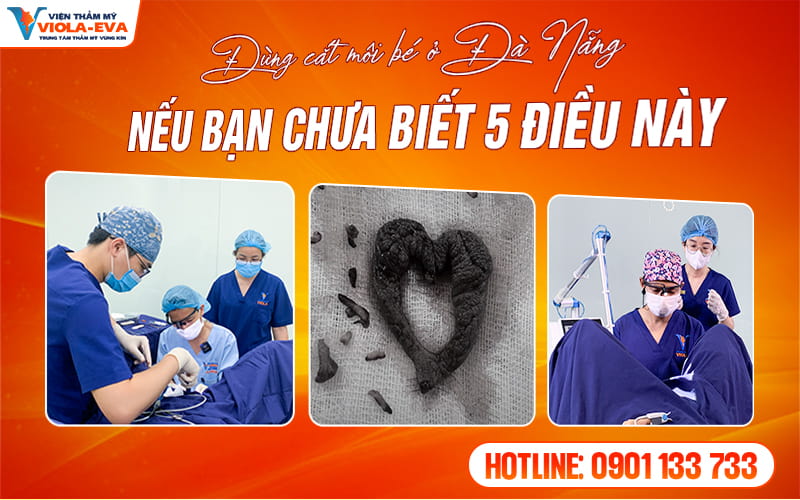 lao-hoa-khong-con-la-noi-lo-voi-cang-da-mat-tai-da-nang