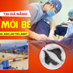 cat-moi-be-o-da-nang-co-dat-khong-bao-lau-thi-lanh